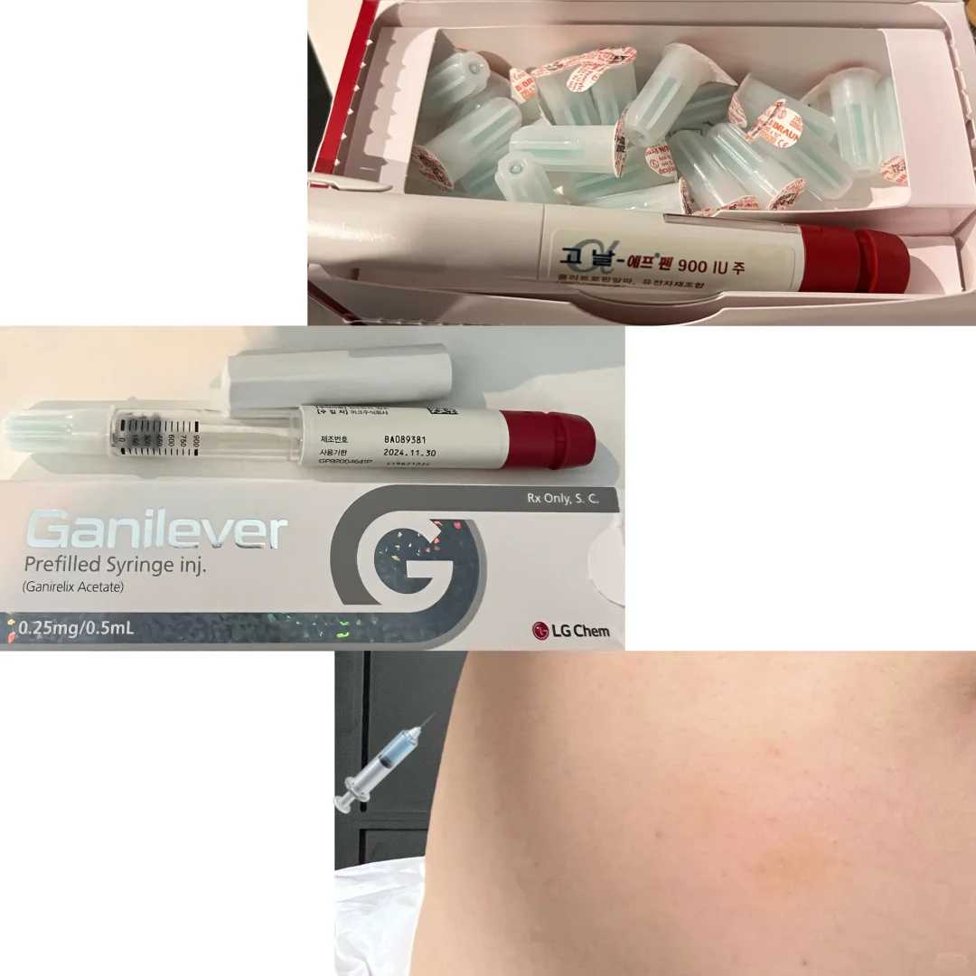 <strong>贵阳供卵试管中心排行（葫芦岛供卵代怀）</strong>